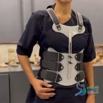 کمربند TLSO ارتز TLSO